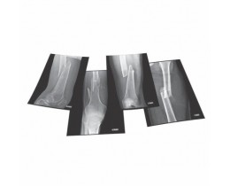 Four Fractures X-Rays